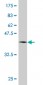 HNRPM Antibody (monoclonal) (M01)